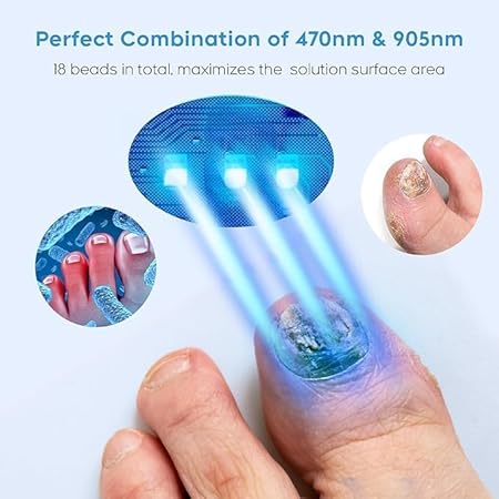 Dispositivo de tratamiento de hongos en las uñas - additional image 4