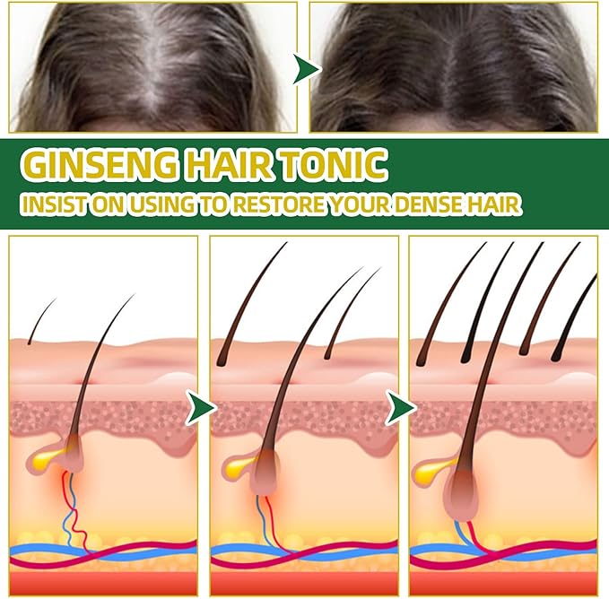 Spray para crecimiento del cabello de ginseng - additional image 1