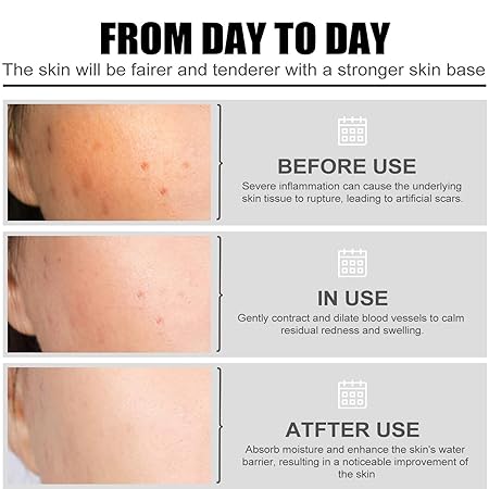 Serum facial con nicotinamida para cuidado de la piel - additional image 15